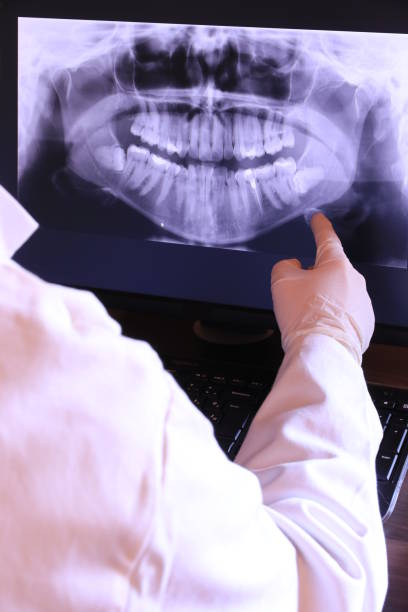 Best Emergency Wisdom Teeth Removal in Pendergrass, GA